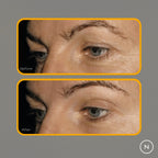 Before and after skin comparison highlighting eye area changes.