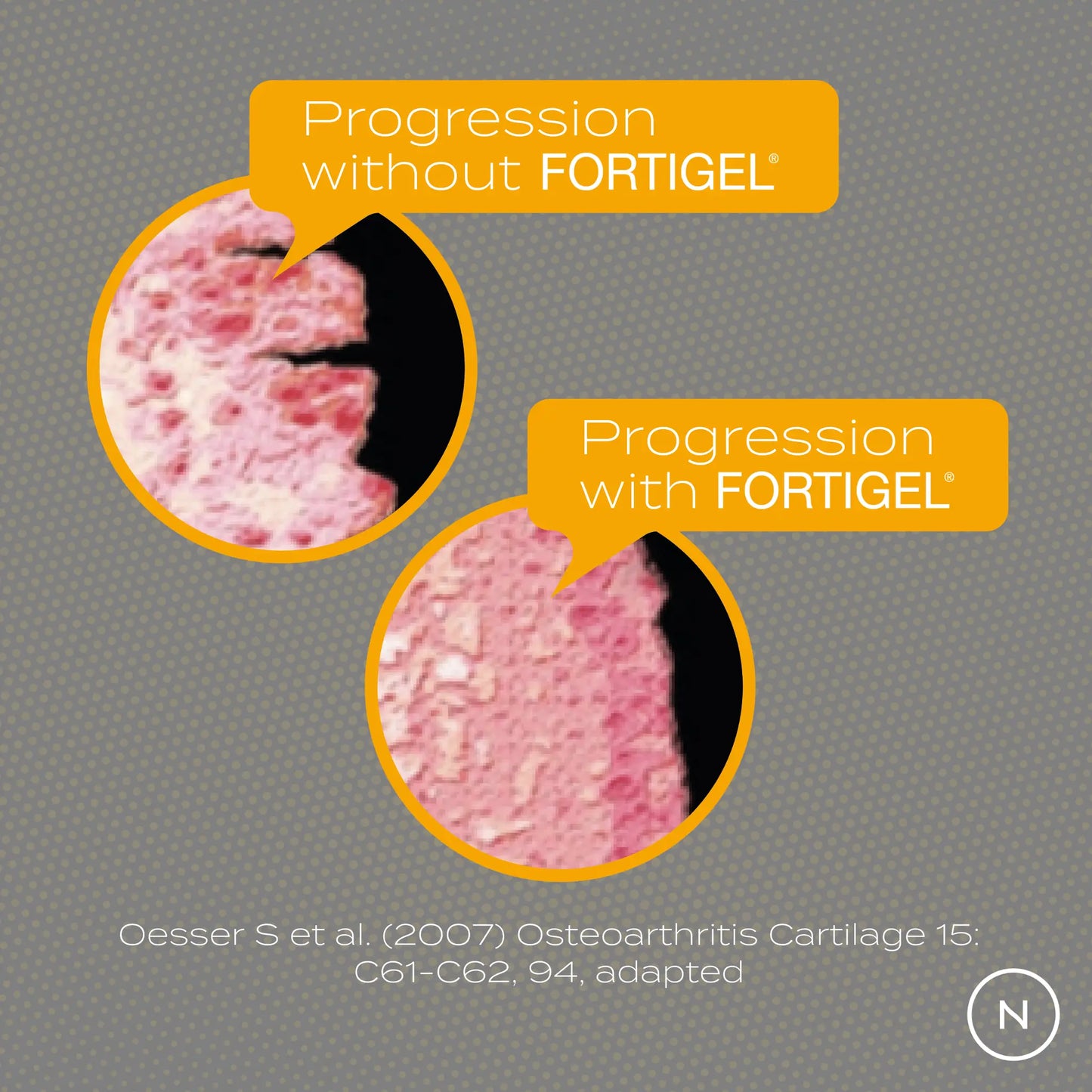 Comparison of joint cartilage progression with and without FORTIGEL, showing different textures and conditions.
